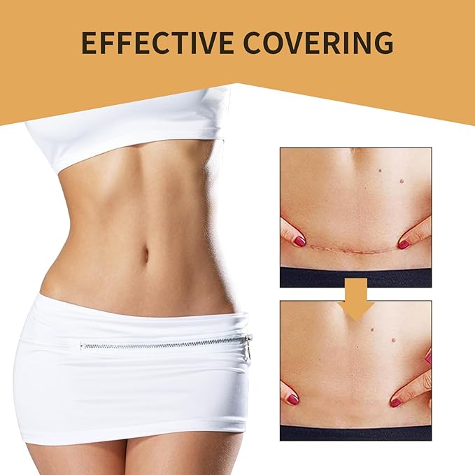 Tattoo Cover Up,Scar Cover Stickers Tape,Waterproof Ultra Thin Patch Pads Concealer Body Leg Bruise Stretch Scar Dark Spots Vitiligo Skin Makeup,Long Lasting Invisible Tattoo Flaw Conceal Patch - 6PCS