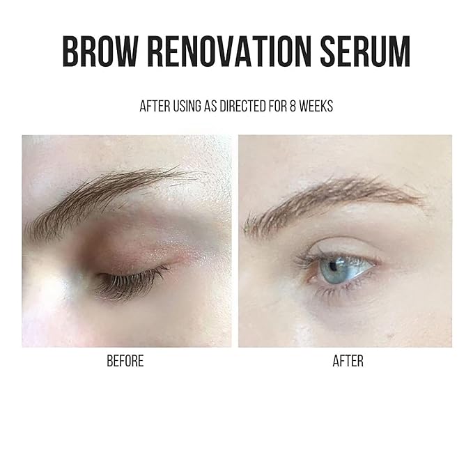 Joey Healy Brow Renovation Serum, Eyebrow Enhancer, Paraben & Hormone free with Vitamins and Botanical Ingredients for Fuller Brow Growth