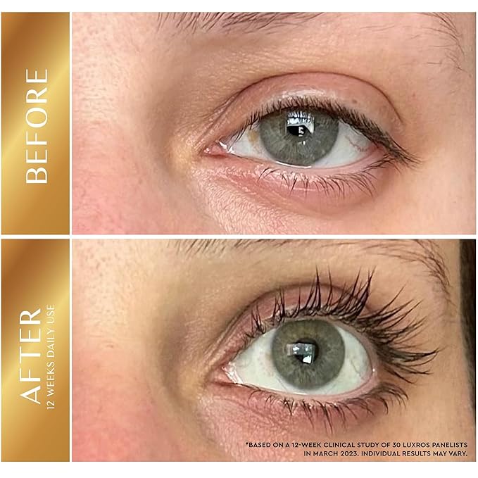 Eyelash Growth Serum 5 mL: Get Thick, Strong Lashes in Just 3-4 Weeks with Our Plant-Based Eyelash Growth Serum - No Parabens - Made in USA