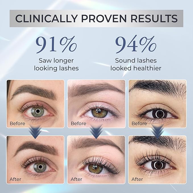 Abera Misan Eyelash Growth Serum (Upgrade Version) - Natural Lash Booster and Lash Enhancer, Regenerating and Nourishing Lashes Longer and Thicker (3. Set of 3 with Gift)