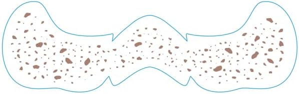 Face Makeup Patches - Glitter Freckles, Easy to Create Charming Freckles, Suitable for Daily and Party use-Five Optional Designs