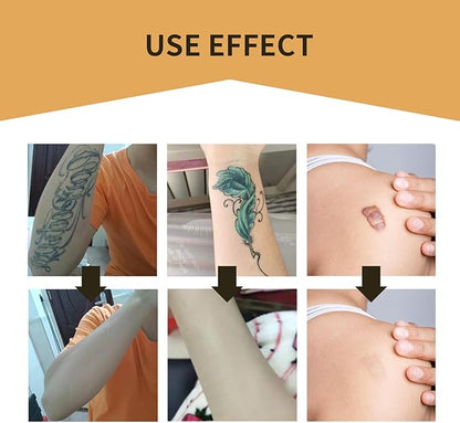 Tattoo Cover Up,Scar Cover Stickers Tape,Waterproof Ultra Thin Patch Pads Concealer Body Leg Bruise Stretch Scar Dark Spots Vitiligo Skin Makeup,Long Lasting Invisible Tattoo Flaw Conceal Patch - 6PCS