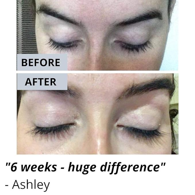 Lash & Brow Booster Serum Gives You Longer Fuller Thicker Looking Eyelashes & Eyebrows. Bestselling Conditioner Stimulates The Appearance Of Growth & Regrowth. Natural Eye Lash Enhancer