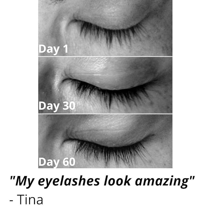 Lash & Brow Booster Serum Gives You Longer Fuller Thicker Looking Eyelashes & Eyebrows. Bestselling Conditioner Stimulates The Appearance Of Growth & Regrowth. Natural Eye Lash Enhancer