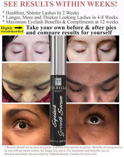 Voibella Eyelash Growth Serum and Eyebrow Appearance Enhancer 8.87ML - Natural Eye Lash Beauty Enhancing and Brow Serum To Boost Healthy Aspect and Show Thick, Longer, Lush and Lavish Lashes