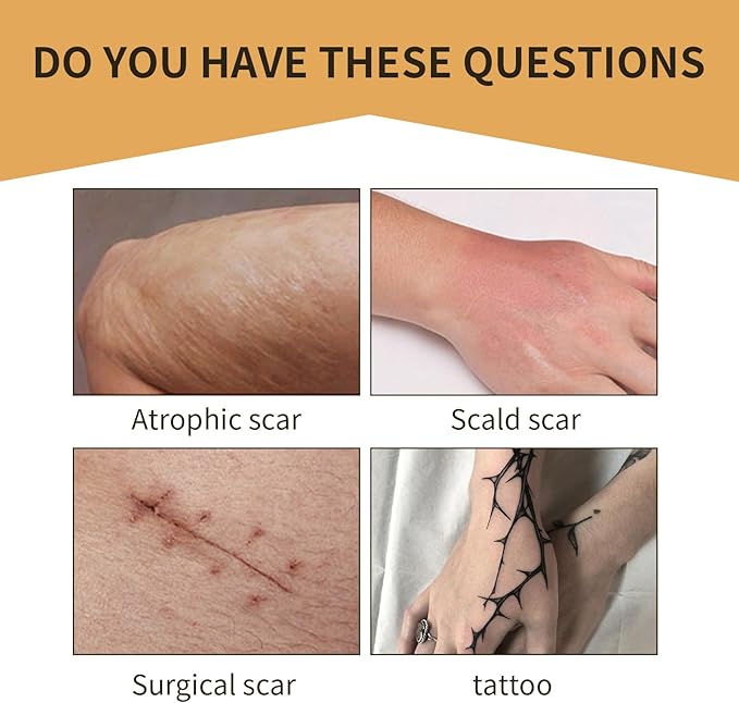 Tattoo Cover Up,Scar Cover Stickers Tape,Waterproof Ultra Thin Patch Pads Concealer Body Leg Bruise Stretch Scar Dark Spots Vitiligo Skin Makeup,Long Lasting Invisible Tattoo Flaw Conceal Patch - 6PCS