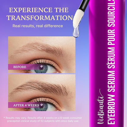 VieBeauti Eyebrow Growth Serum: Eyebrow Serum to Grow Brows with Advanced Formula to Boost Longer Fuller and Thicker Looking Eyebrows 3mL