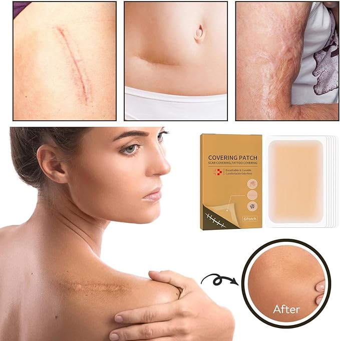 Tattoo Cover Up,Scar Cover Stickers Tape,Waterproof Ultra Thin Patch Pads Concealer Body Leg Bruise Stretch Scar Dark Spots Vitiligo Skin Makeup,Long Lasting Invisible Tattoo Flaw Conceal Patch - 6PCS