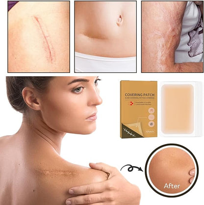Tattoo Cover Up,Scar Cover Stickers Tape,Waterproof Ultra Thin Patch Pads Concealer Body Leg Bruise Stretch Scar Dark Spots Vitiligo Skin Makeup,Long Lasting Invisible Tattoo Flaw Conceal Patch - 6PCS