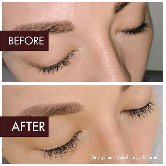 Eyelash Growth Serum - Longer, Fuller And More Voluminous Lashes - Vegan And Cruelty Free - Exclusive High-Tech Formula - Contains Moisturizing, Soothing And Active Ingredients - 0.1 Oz